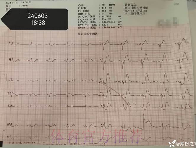 莫德里奇出现发烧症状 经检查已排除新冠感染